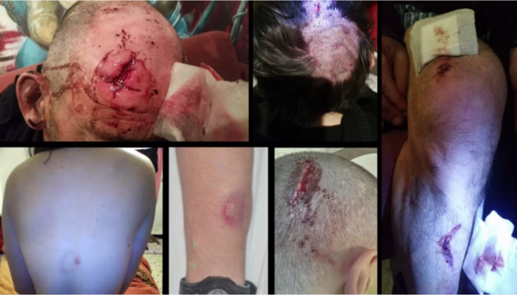 Photos de quelques blessés suite aux violences policières